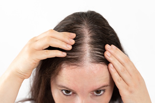 Female Hair Restoration Options From A Medical Spa
