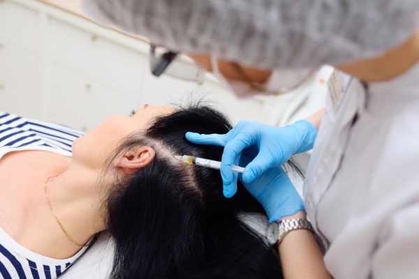 Hair Restoration For Women: What Causes Hair Loss?