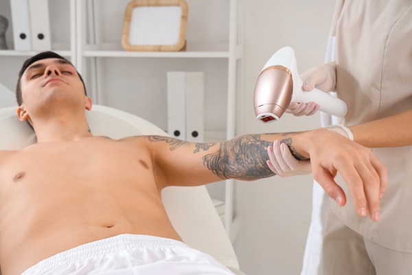 How Laser Tattoo Removal Can Transform Your Skin