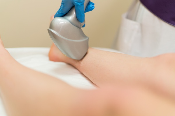 A Guide To Laser Vein Therapy