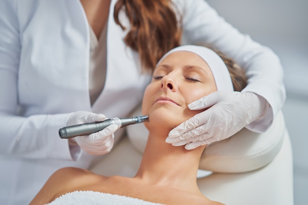 How Microneedling Is Used As A Skin Treatment