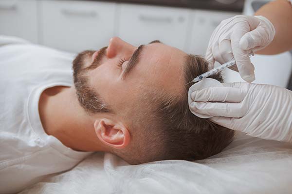 When To Consider PRP Therapy For Hair Restoration
